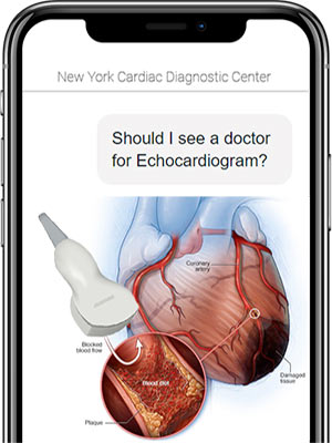 Should I see a doctor for Echocardiogram?