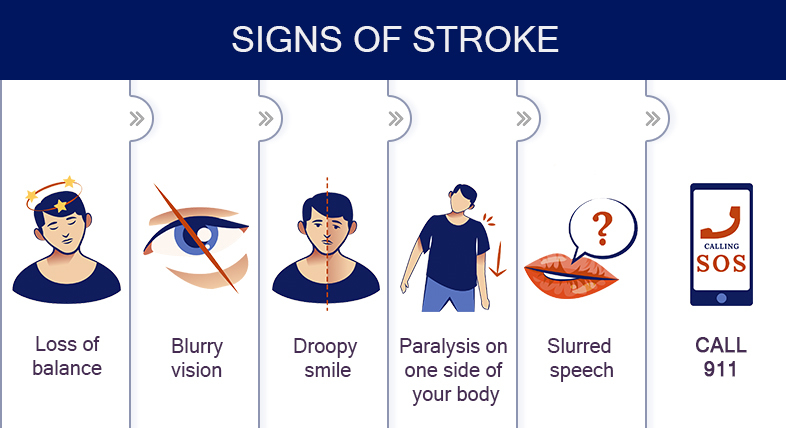 Signs that you’re having a stroke